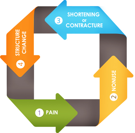 pain/nonuse/shortening or contracture/structure change/pain